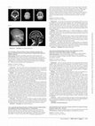 Research paper thumbnail of Congenital Neurological Disorders in Children with Microcephaly Related to Exanthematous Diseases During Pregnancy: A Cohort Study