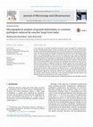 Research paper thumbnail of Micrographical analysis of growth deformities in common pathogens induced by voucher fungi from India