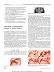 Research paper thumbnail of Oro Nasal Communication Closure in Smoker Patient