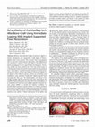 Research paper thumbnail of Rehabilitation of the Maxillary Arch After Bone Graft Using Immediate Loading With Implant-Supported Fixed Restoration