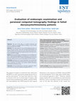 Research paper thumbnail of Evaluation of endoscopic examination and paranasal computed tomography findings in failed dacryocystorhinostomy patients