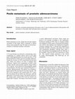 Research paper thumbnail of Penile metastasis of prostatic adenocarcinoma