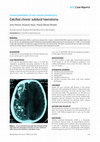 Research paper thumbnail of Calcified chronic subdural haematoma