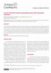 Research paper thumbnail of A case of dual left anterior descending artery with myocardial infarction