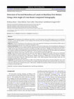 Research paper thumbnail of Detection of Second Mesiobuccal Canals in Maxillary First Molars Using a New Angle of Cone Beam Computed Tomography