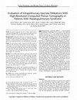 Research paper thumbnail of Evaluation of Intrapulmonary Vascular Dilatations With High-Resolution Computed Thorax Tomography in Patients With Hepatopulmonary Syndrome