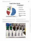 Research paper thumbnail of P447 Galactomannan lateral flow assay for the diagnosis of invasive Aspergillosis among clinically suspected patients in tertiary care center, Jodhpur, Rajasthan