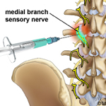 Nerve block injection test