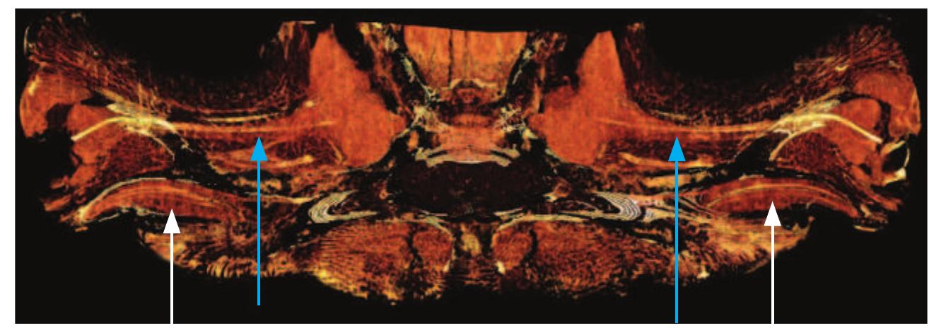 Figure 1 Olfactory organs to absorb scent (olfactory rosettes) in Sphyrna lewini as illustrated by white arrows, and optic nerves with blue arrows (computed tomography scan with false colour).  -— Sewer eee  Florida Atlantic University, Florida, USA  Much like other elasmobranchs, sharks accommodate using a protractor lentis, which pulls the lens away from the retina as compared with teleosts (bony fish) that have a retractor lentis muscle that moves the lens towards the retina (BJO April 2006). This suggests that the last common ancestor of sharks and teleosts, mentioned above, probably had rudimentary, if any, accommodation. Accommodation must 