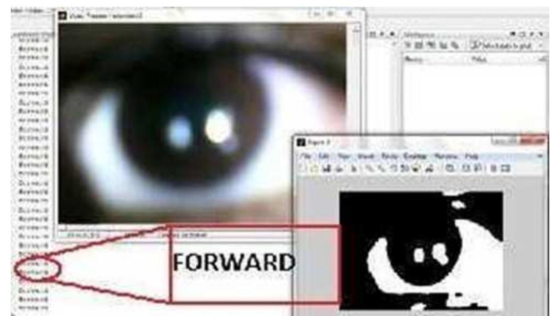 Fig. 6 Forward position detected on MATLAB  When the operator moves his eyes in left direction, white pixels are decreased in sector 1, increased in sector 2 and remains constant in sector 3 . By this comparison with reference image, decision is taken to take a left turn similarly when the operator looks in right direction, white pixels are decreased in sector 3, increased in sector 2 and remains constant in sector | and decision is taken to move wheelchair in right direction. 