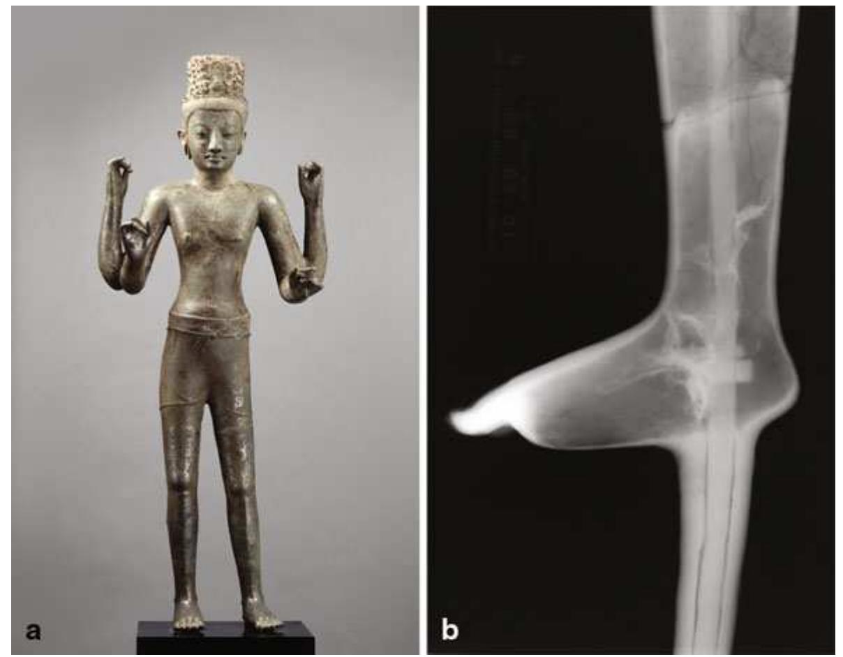 Fig. 12.23 a Four-armed Avalokiteshvara, the Bodhisattva of Infinite Compassion, Thailand Prakhon Chai, Buriram Province, 2nd quarter of 8th cen. Hollow cast high-tin bronze, silver, and black glass or obsidian inlays, H. 142.2 cm. Rogers Fund, 1967 (67.234). b Gamma-ray radio- sraph of left leg showing armature embedded in casting core; irregular radiopaque patches at and above ankle can be attributed to fins formed on wall interior(s) where molten metal penetrated the Sore during casting. (Images © The Metropolitan Museum of Art) 