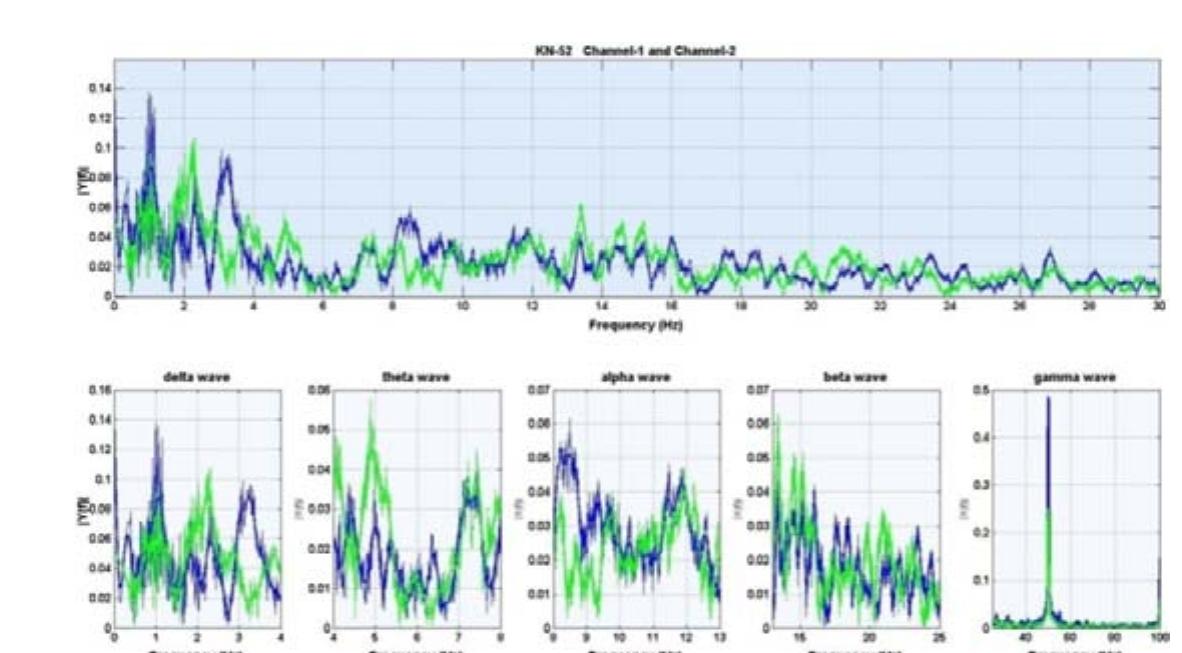 Figure 3: The power spectrum of the two signals (see also Figure 2). In the bottom row we have the power spectrum of the biologically significant frequency bands (delta  (5 0-4Hz), theta (0 4-8Hz), alpha (a 8-13Hz), beta (B 13-25Hz) and gamma (y >25Hz)). In the gamma band it is visible the noise of 50Hz power supply network effect. 