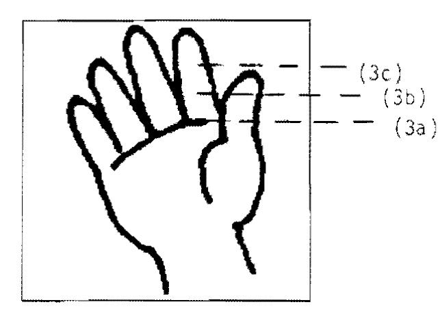 The combinations of flexion and extension of these joints yield four logically possible configurations of the hand. First, the fingers can be "extended", as shown in (4), in which there is no flexion at MCP, PIP or DIP joints,  fingers is the knuckle, or metacarpophalangeal (MCF) joint, shown in (3a). The second joint on the I, M, R and P is the proximal interphalangeal (PIP) joint, shown in (3b). Finally, the joint closest to the fingertip of the I, M, R and F is the distal interphalangeal {DIP} joint, shown in (3c). The PIP and DIP joints generally function  as a unit (Brand, 1985). 