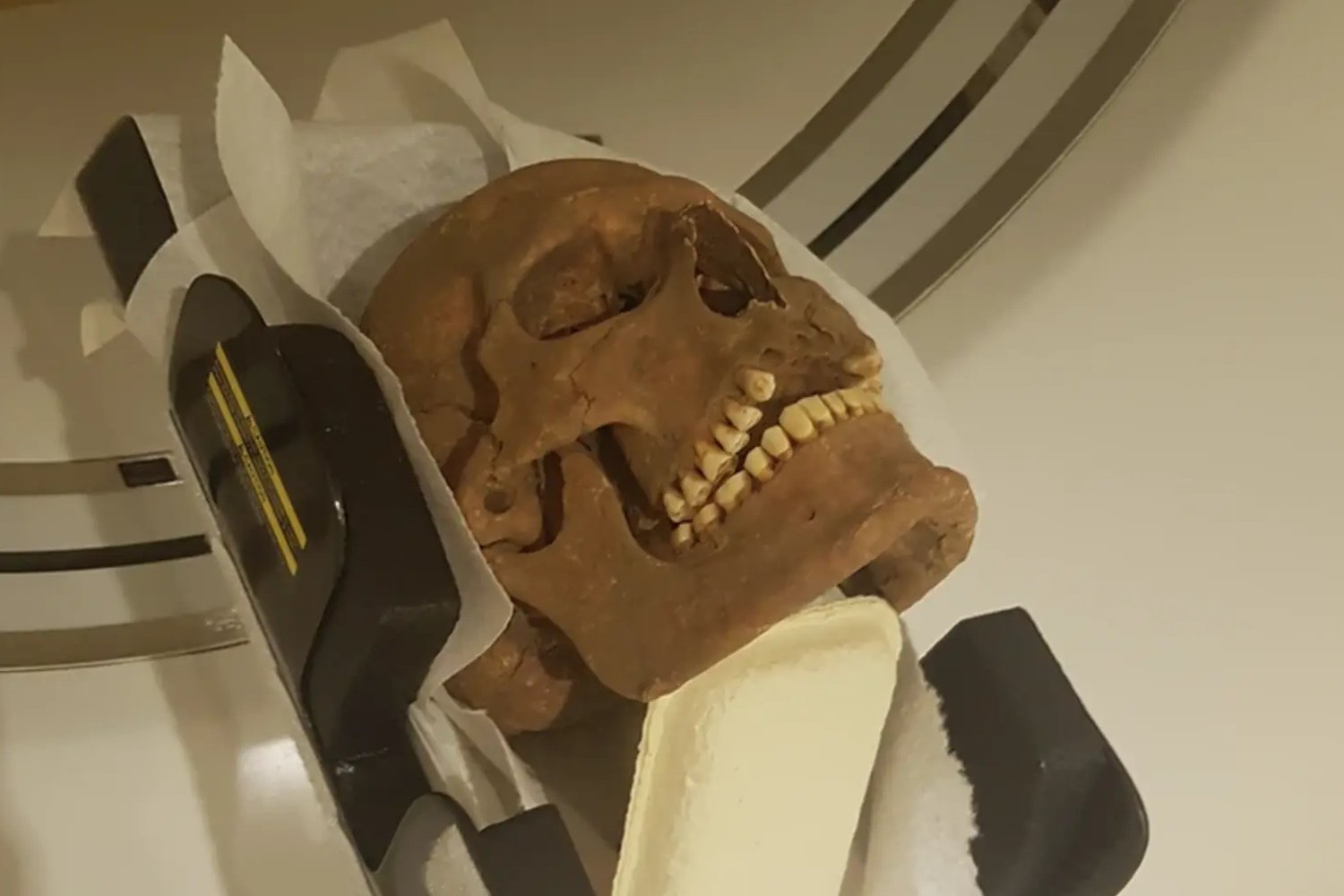 Image of a Viking skull undergoing a CT scan