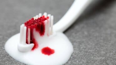 gum bleeding oral hygiene ke liye tension ka karan ho sakti hai