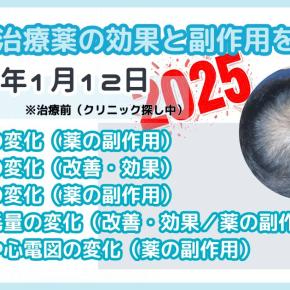 薄毛40代男性のAGA治療ブログ｜前週と今週の状態を比較【2025年1月12日(日)】
