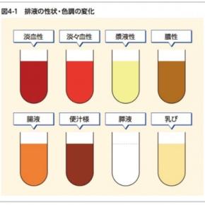 腹腔ドレナージが乳び色に