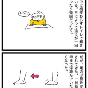 弾性ストッキングのその後。