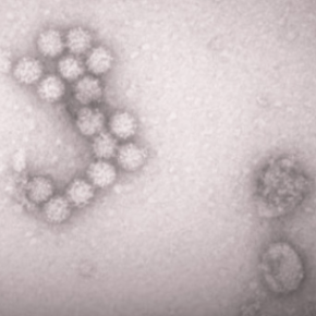 「スマホ食中毒」って？