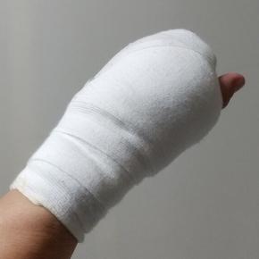 痛み止めが効いている バネ指