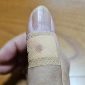 気圧の変化と手先足先の痺れと関節痛