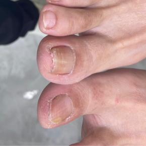 爪棘（ソウキョク）とは…