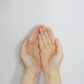 【手のむくみ】リンパドレナージュでもすぐ元に戻る顔のむくみと二の腕の浮腫のケース