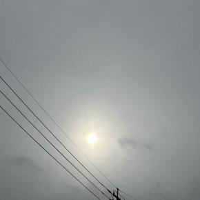 歩行禁止令解除の朝！入院生活に光が見えてきた♪〜形成外科入院中〜