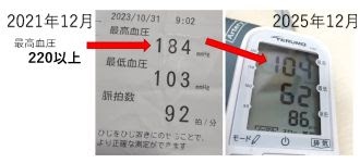 血圧220→104 4年かけて半減以下にした話 清貧生活のブログ