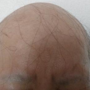 「石破、総理辞めるってよ」…それなら、私、婚活やめようかな？と思った理由