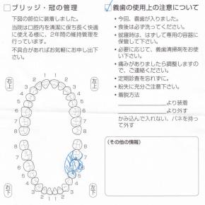 奥歯の抜歯と義歯