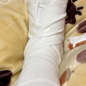 骨折してました＿ ￣ ○