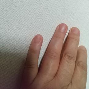 リウマチ痛だと思ってたら