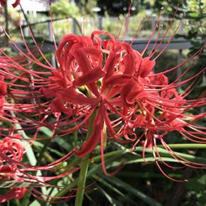 マンモグラフィ