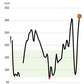 ストレスに比例しやすい