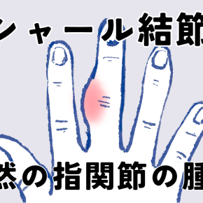 ブシャール結節になっちゃった！？絶望から一転、天国へ。中指の腫れの正体