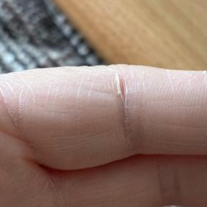 冬の、痛い肌のひび割れ