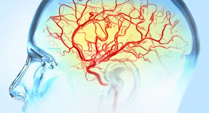 Neurovascular Services