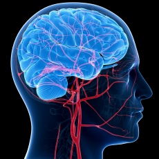 Arteriovenous Malformations