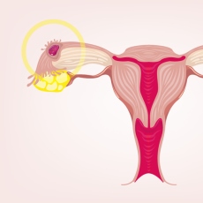 Ectopic Pregnancy