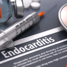 Endocarditis