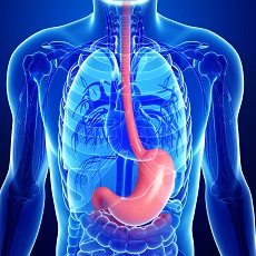 Eosinophilic Esophagitis