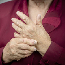 Rheumatoid Arthritis