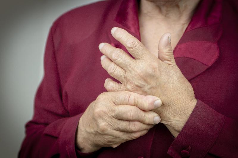 Rheumatoid Arthritis