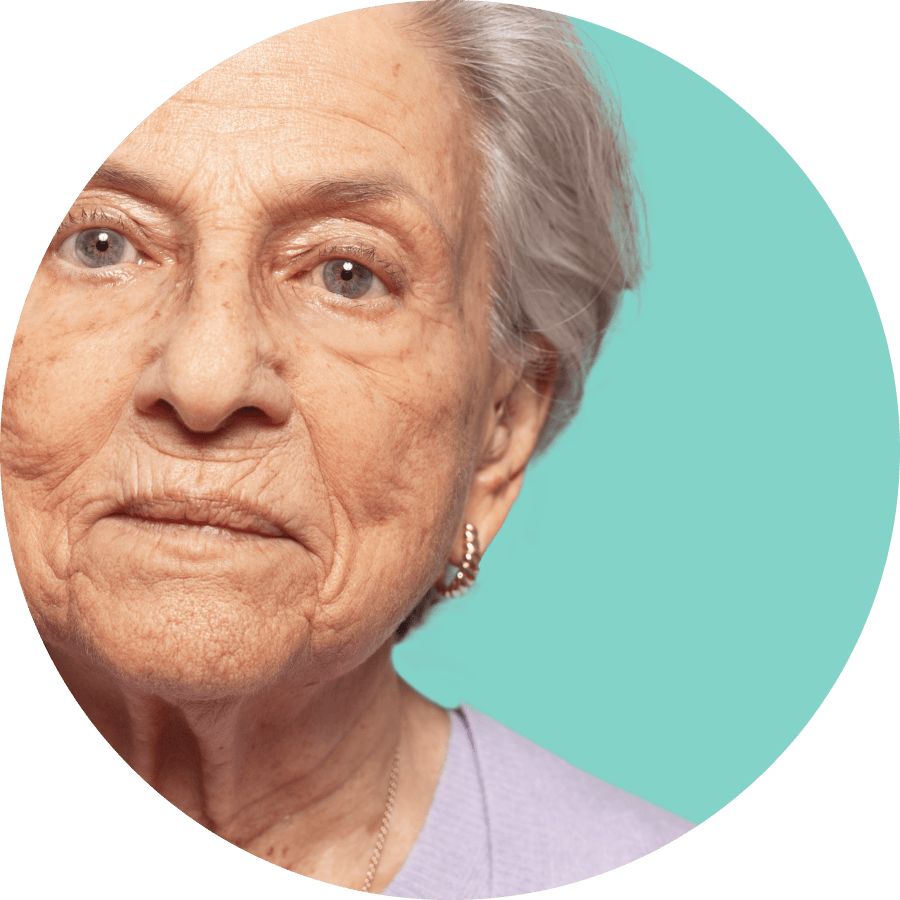 growing older and melasma