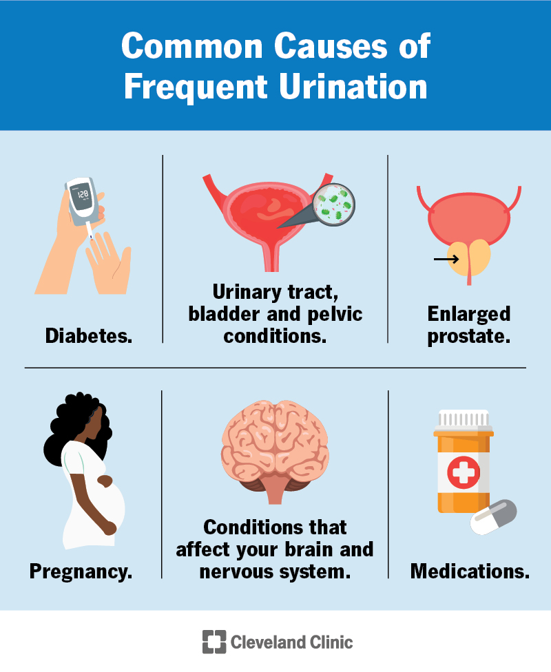 Common causes of frequent urination include: diabetes, pregnancy, enlarged prostate, urinary and bladder conditions and more