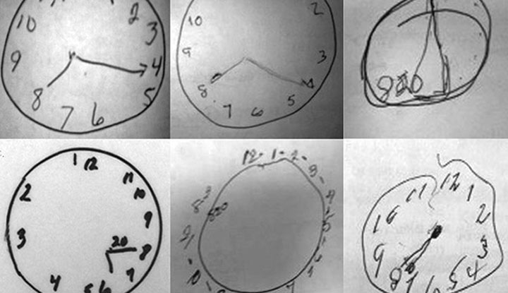 A cognitive test checking cognitive function by sketching a clock face with numbers and hands for a specific time