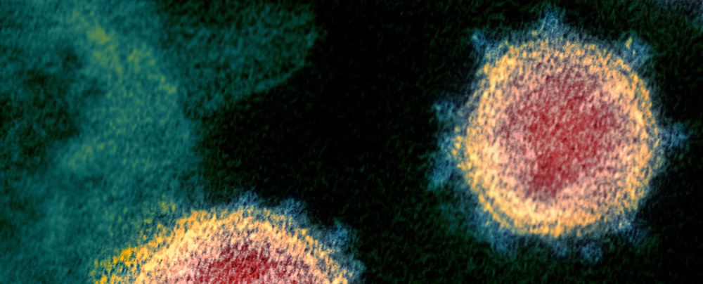 Coronavirus image from NIH