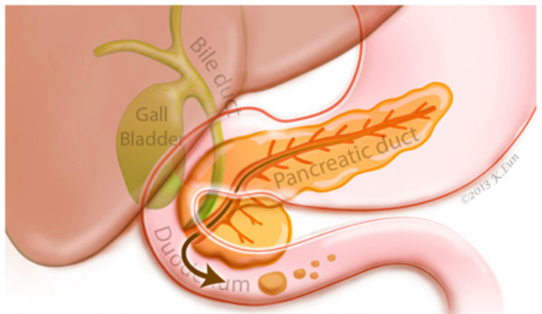 Pancreatic fluid