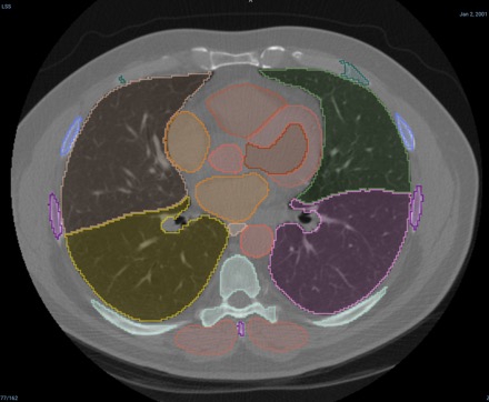 CT Example Image